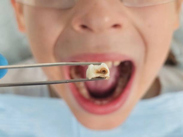Best After-Hours Emergency Dentist in Byram, MS